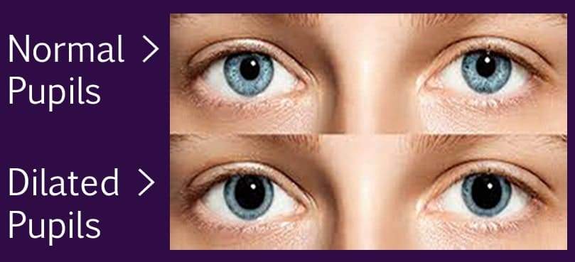 Dilated Pupils 809 x 369-min